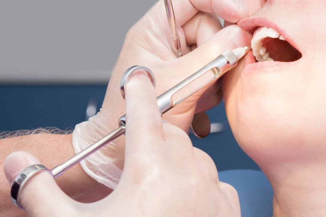 How Safe Is Intravenous Sedation for Dental Procedures